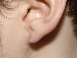 split ear repair hurren consultant