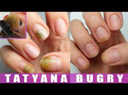 restoring nails from bacteria