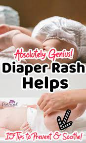 15 helps for diaper rash pint sized