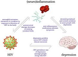 hiv ociated depression