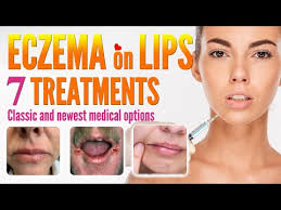 lip eczema around mouth dermais