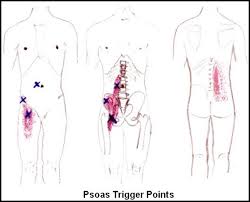 Lower Back Pain Trigger Points