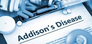 أسباب مرض أديسون - موضوع