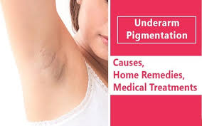underarms pigmentation causes