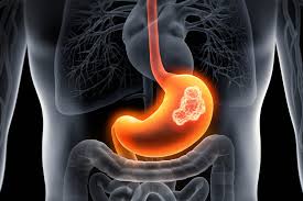 Gastroscopy: what it is and what it is for