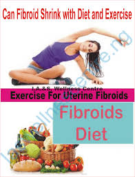 fibroids shrink with t and exercise