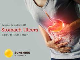 causes and symptoms of stomach ulcers