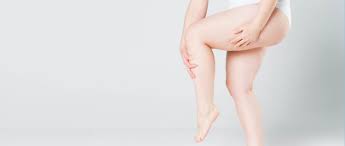 liposuction for lipoedema london