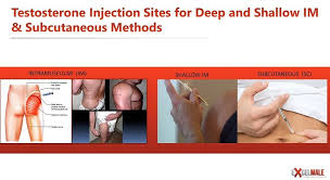 intramuscular vs subcutaneous injections