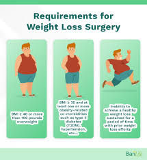 gastric sleeve vs lap band which is