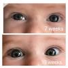 Jul 08, 2020 · your baby's eyes are probably their final color now. 1