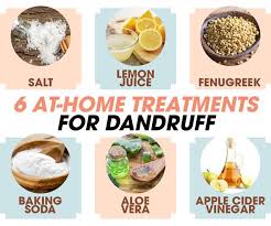 top at home treatments for dandruff