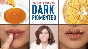 how to treat dark pigmented lips