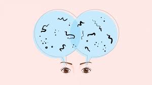eye floaters causes symptoms and