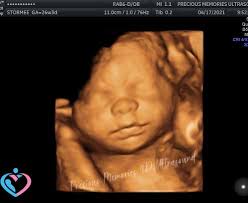 4d pregnancy ultrasounds atascocita tx