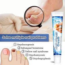 ruike 20g nail repair cream toenail