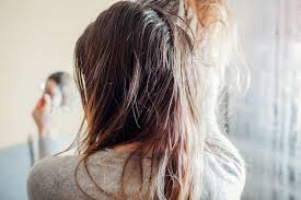 oily hair causes washing hormones