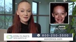 eon clinics testimonials jamie