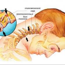 Болката в рамото може да възникне в самата става или околните мускули, връзки и. Vazhno E Da Znaete Ako Imate Bolka Vv Vrata Si Molya Napravete Tova Za Zhenata
