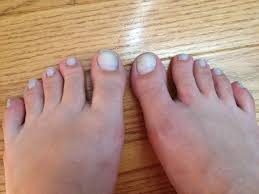 whiten toenails with toothpaste pintester