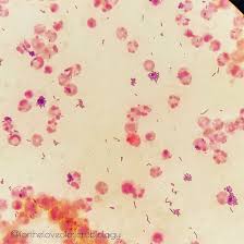 Monocytogenes contamination of sliced deli meats at the retail level is a significant. Fortheloveofmicrobiology S Tweet Listeria Monocytogenes On A Gram Stain From A Positive Blood Culture They Appear As Regular Short Gram Positive Rods Singly Or In Chains But They Can Also Be Arranged