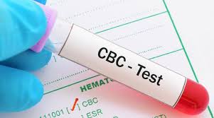 A cbc determines if there are any increases or decreases in your blood. A Lowdown On Cbc Blood Test