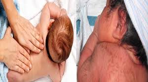 remes to remove baby hair naturally