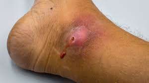 telltale signs that a wound is healing