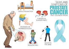 Thirteen Facts Prostate Health Prostate Cancer Symptoms And Signs