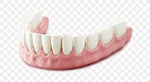 Human Tooth Dentures Dentistry Prosthesis, PNG, 634x451px, Tooth, Bleeding  On Probing, Cosmetic Dentistry, Dental Extraction, Dental