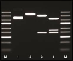10 Curious Restriction Enzyme Buffer Chart