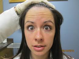 Image result for face eyebrows raised