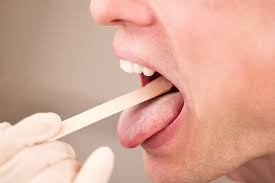 Candidiasis in the mouth and throat can have many different symptoms, including: Zungenpilz Ursachen Und Behandlung Heilpraxis