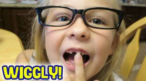 However, teeth tend to stay in place, even if loose thanks to their strong root structure. Pulling Teeth Loose Tooth Won T Come Out Youtube