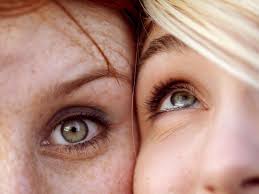 thin skin under eyes causes symptoms