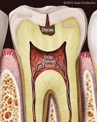 If a patient experiences tooth sensitivity or pain even months after a cavity filling, one can assume an underlying cause. Tooth Pain Dentist Rocky River Oh Dental Education Library