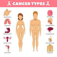 testicular cancer symptoms diagnosis