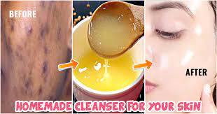 homemade cleansers for combination skin