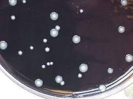 buffered charcoal yeast extract agar