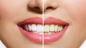Yellow Teeth Are Actually Stronger Than Bright White Teeth