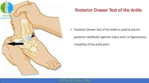 posterior drawer test ankle 2023