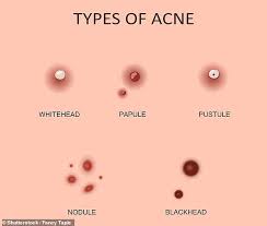 The Six Types Of Pimple And How To Deal With Each One