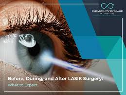 before during and after lasik surgery