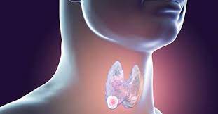 Cancer can develop in almost any tissue or organ of the body such as the throat, lung, colon, breast, skin, bones or nerve tissue. Throat Cancer Early Signs Common Symptoms Indus Heath Plus