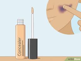 3 ways to cover up a bruise wikihow