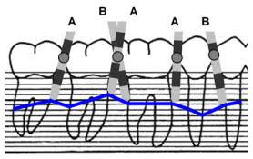 Periodontal Chart Department Of Periodontology School Of