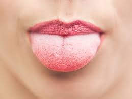 causes of inflamed swollen taste buds