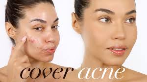 how to cover acne with makeup eman