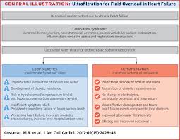 Extracorporeal Ultrafiltration For Fluid Overload In Heart