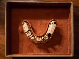 Contrary to popular myth, george washington did not have wooden teeth. The Strange Story Of George Washington S Dentures How They Ended Up In Nyc Gothamist